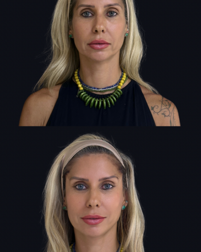 a0bc816c31a8b52b717ad6ac4e0e3568 a0bc816c31a8b52b717ad6ac4e0e3568